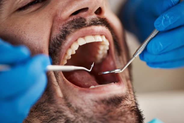 Best Broken or Chipped Tooth Repair in Metlatla, AK